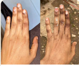 Skin Brightening · Hands
