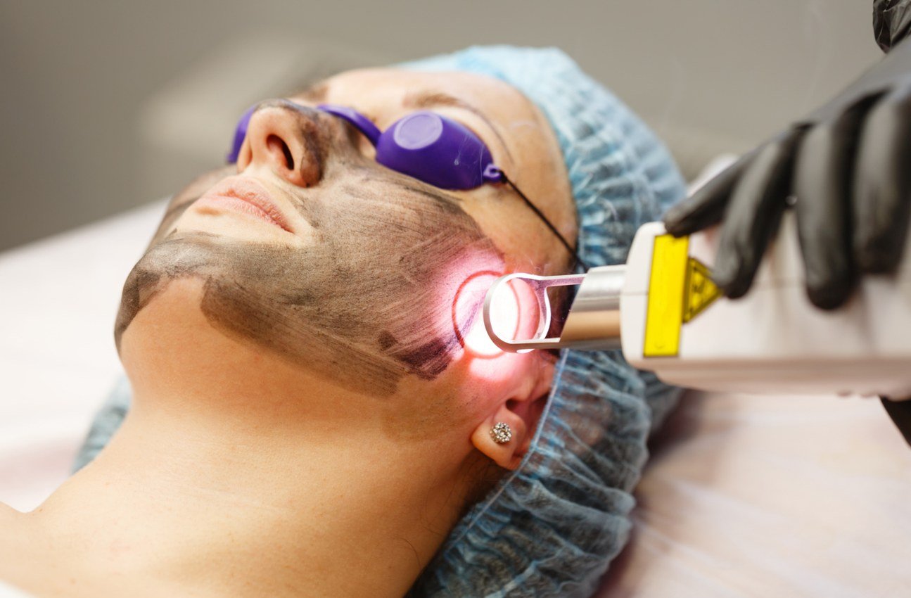Pigmentation and laser toning treatment visual